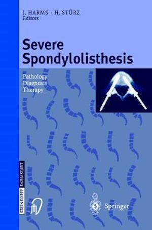 Severe Spondylolisthesis : Pathology - Diagnosis - Therapy
