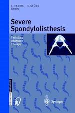 Severe Spondylolisthesis : Pathology - Diagnosis - Therapy 