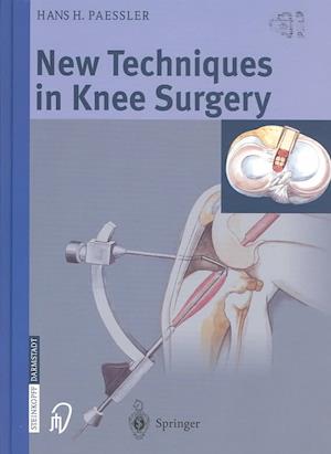 New Techniques in Knee Surgery