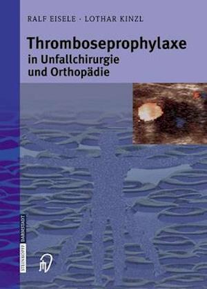 Thromboseprophylaxe in Unfallchirurgie und Orthopädie