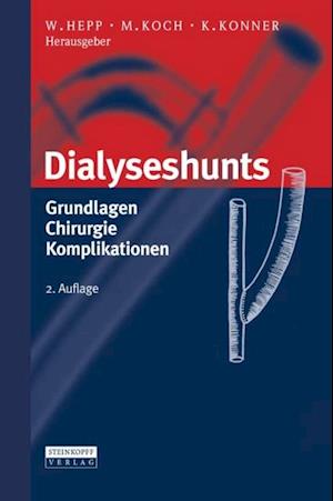 Dialyseshunts