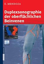 Duplexsonographie der oberflächlichen Beinvenen