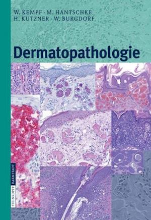 Dermatopathologie