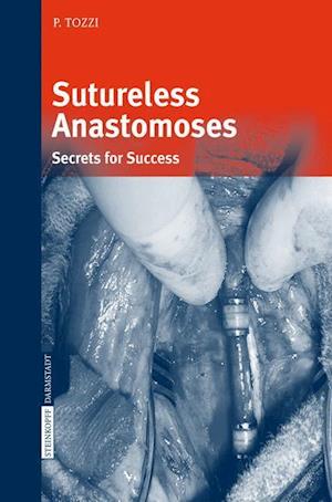 Sutureless Anastomoses