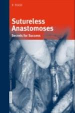 Sutureless Anastomoses