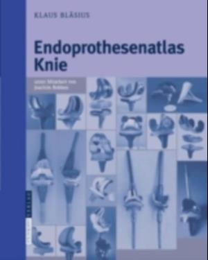 Endoprothesenatlas Knie