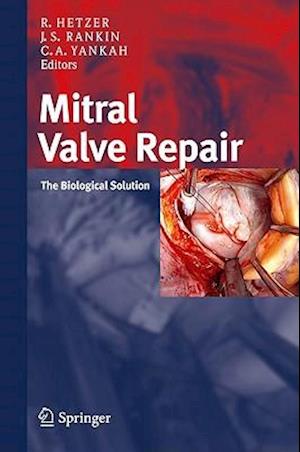 Mitral Valve Repair