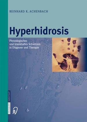 Hyperhidrosis