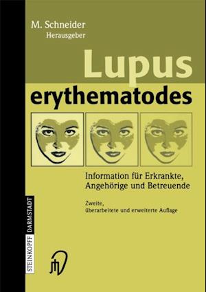 Lupus erythematodes