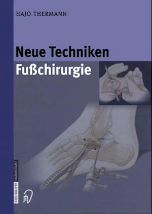 Neue Techniken Fusschirurgie