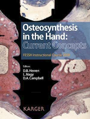 Osteosynthesis in the Hand: Current Concepts