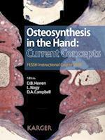 Osteosynthesis in the Hand: Current Concepts