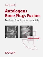 Autologous Bone Plugs Fusion