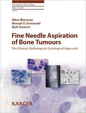 Fine Needle Aspiration of Bone Tumours