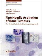 Fine Needle Aspiration of Bone Tumours