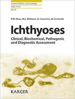 Ichthyoses