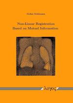 Non-Linear Registration Based on Mutual Information