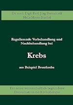 Regulierende Vorbehandlung und Nachbehandlung bei Krebs am Beispiel Brustkrebs