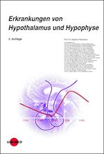 Erkrankungen von Hypothalamus und Hypophyse