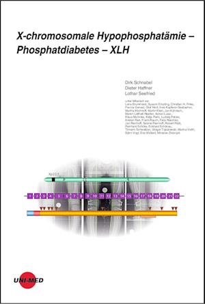 X-chromosomale Hypophosphatämie - Phosphatdiabetes - XLH