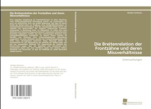 Die Breitenrelation der Frontzähne und deren Missverhältnisse