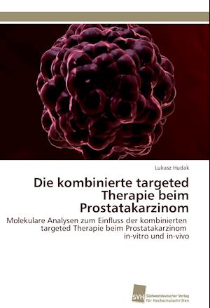 Die Kombinierte Targeted Therapie Beim Prostatakarzinom