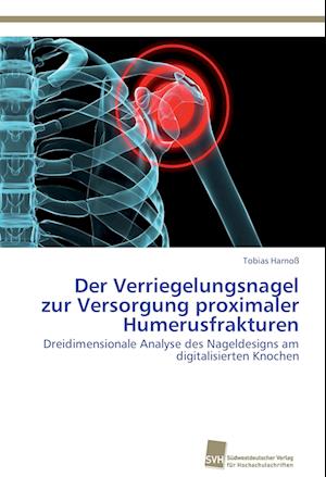 Der Verriegelungsnagel Zur Versorgung Proximaler Humerusfrakturen