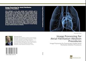 Image Processing for Atrial Fibrillation Ablation Procedures