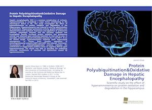 Protein Polyubiquitination&Oxidative Damage in Hepatic Encephalopathy