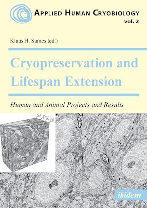 Cryopreservation and Lifespan Extension. Human and Animal Projects and Results