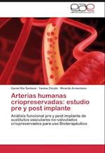 Arterias humanas criopreservadas: estudio pre y post implante