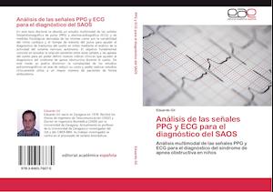 Análisis de las señales PPG y ECG para el diagnóstico del SAOS