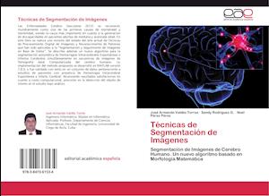 Técnicas de Segmentación de Imágenes