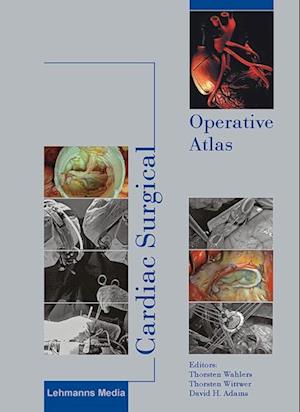 Cardiac Surgical Operative Atlas