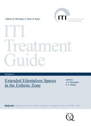 Extended Edentulous Spaces in the Esthetic Zone