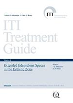 Extended Edentulous Spaces in the Esthetic Zone