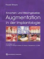 Knochen- und Weichgewebeaugmentation in der Implantologie