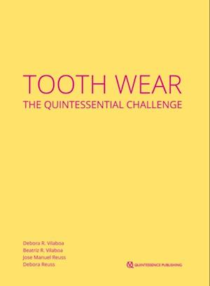 Tooth Wear