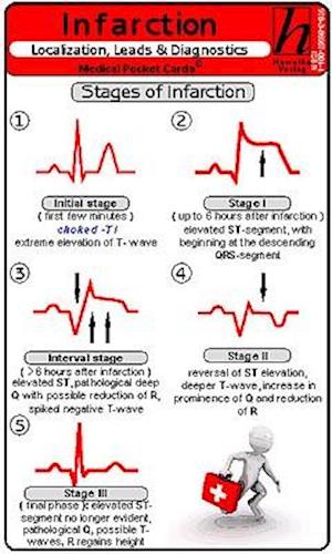 Infarction Localization, Leads & Diagnostics