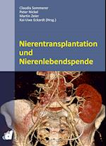 Nierentransplantation und Nierenlebendspende