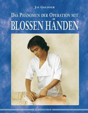 Das Phänomen der Operation mit blossen Händen