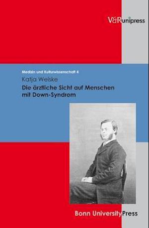 Die Arztliche Sicht Auf Menschen Mit Down-Syndrom