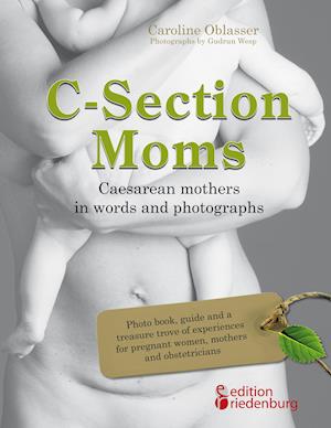 C-Section Moms - Caesarean mothers in words and photographs