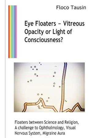 Eye Floaters - Vitreous Opacity or Light of Consciousness?