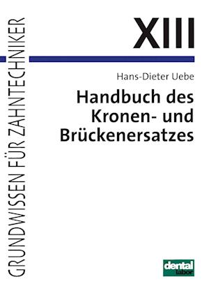 Handbuch des Kronen- und Brückenersatzes