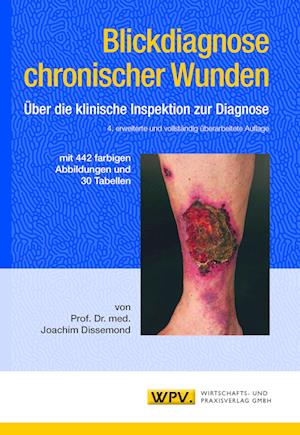 Blickdiagnose chronischer Wunden