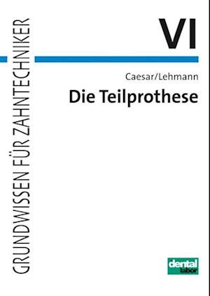 Die Teilprothese