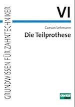 Die Teilprothese