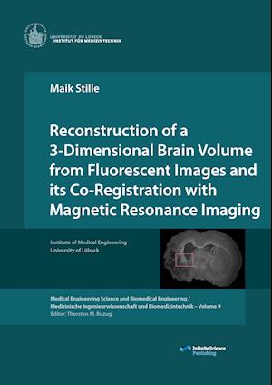 Reconstruction of a 3-Dimensional Brain Volume from Fluorescent Images and its Co-Registration with Magnetic Resonance Imaging