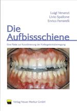 Die Aufbissschiene